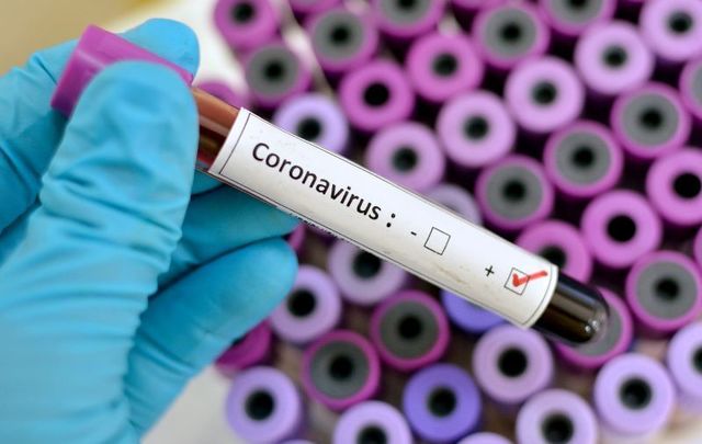 A male has become the first coronavirus patient in Ireland to speak out about his experience.