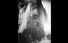 On This Day: The Triangle Shirtwaist Factory tragedy in New York City
