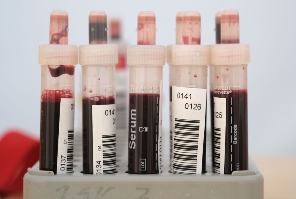 Coronavirus pandemic ends an anti-gay bias from another era