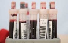 Coronavirus pandemic ends an anti-gay bias from another era