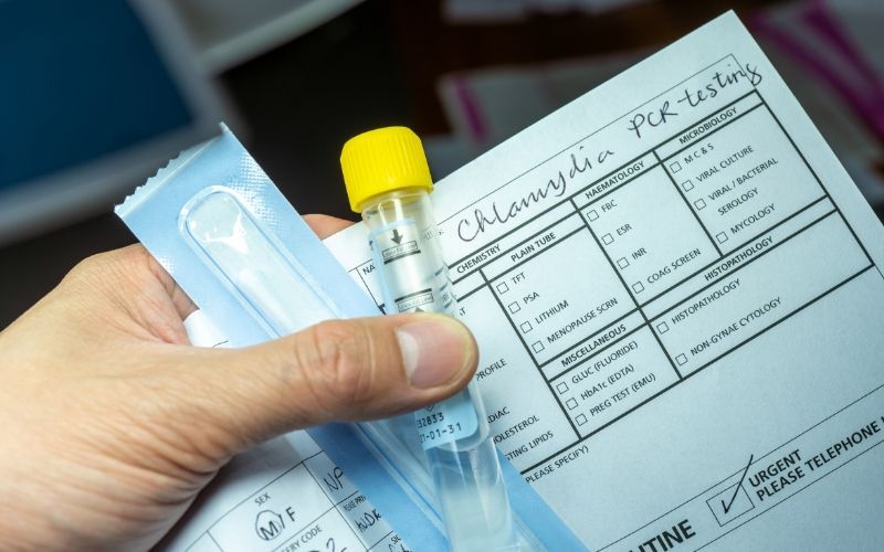 COVID sees sexually transmitted infections in Ireland drop 