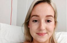 Irish woman, 28, documents horrifying long-term effects of COVID