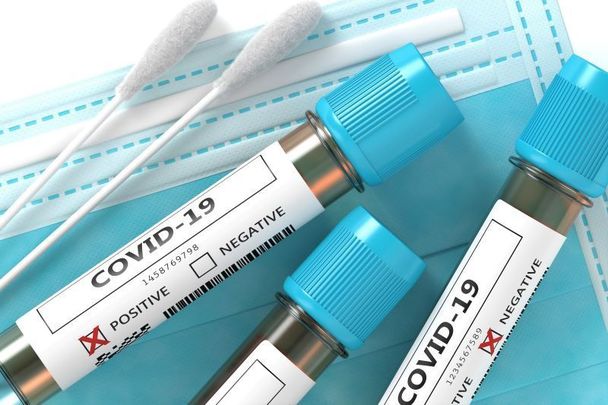 International travelers will be required to produce a negative PCR test result in order to enter Northern Ireland.