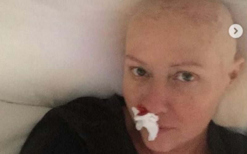 Shannen Doherty reveals reality of cancer treatment to raise awareness