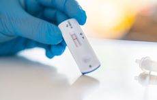 Government reverses decision to offer TDS free antigen tests