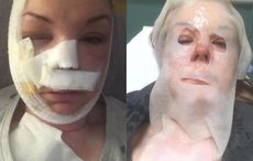 Northern Irish woman's social media plea after egg hack explodes in her face