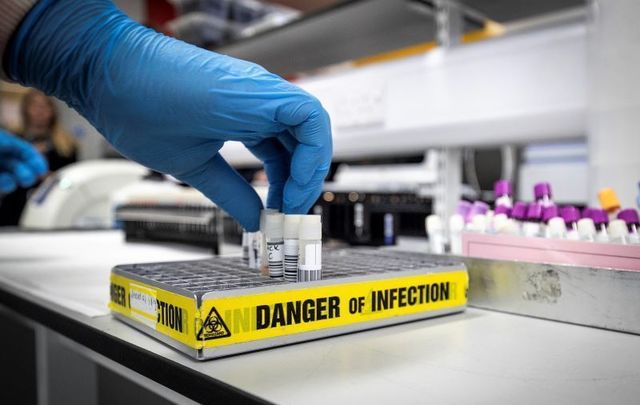 Irish researchers publish findings on COVID immunity.