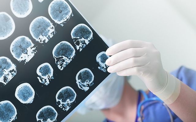 Alzheimer’s Society of Ireland "cautiously optimistic" about new US drug aducanumab