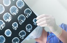 Alzheimer’s Society of Ireland "cautiously optimistic" about new US drug aducanumab