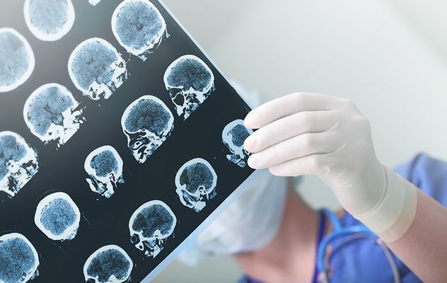 Irish trial shows promise for Alzheimer’s patients