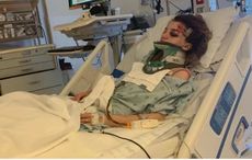 Irish woman injured in California electric scooter accident says she’s lucky to be alive