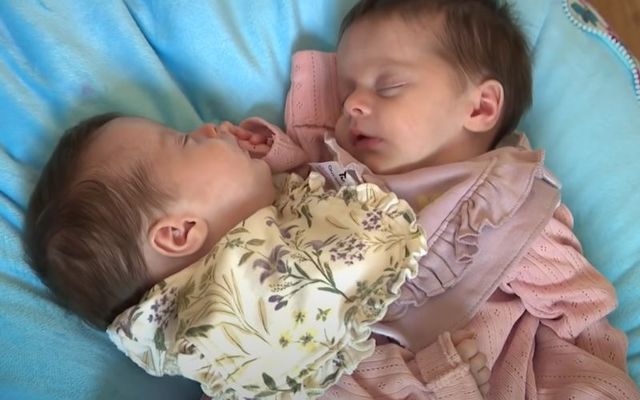 \"Miracle\" Co Antrim conjoined twins Annabelle and Isabelle Bateson are one in 2.5 million.