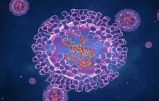 Ireland braces for monkeypox; first case confirmed in Northern Ireland