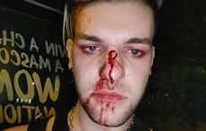 Man spends six hours in hospital after apparent homophobic attack on Dublin Bus