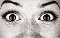 Trinity College team crack gene therapy to treat a common eye condition