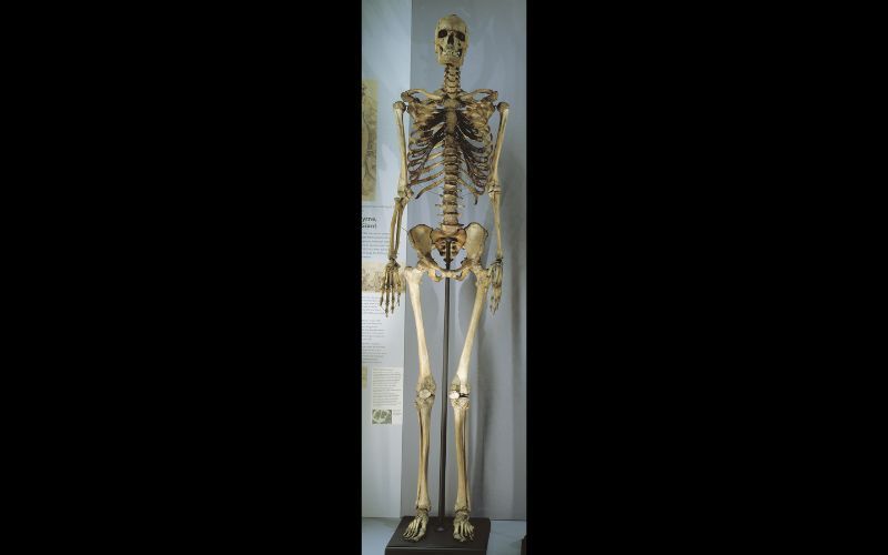 Irish Giant's skeleton will no longer be displayed at London museum