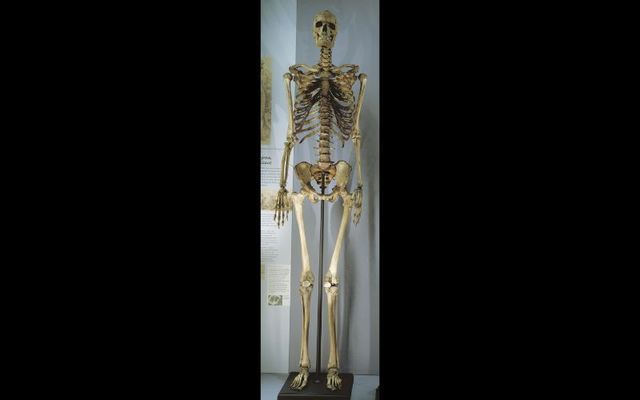 The skeleton of Charles Byrne, the \'Irish Giant,\' will no longer be displayed at the Hunterian Museum in London.