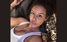 Woman who lost eye in Dublin assault "delighted" with new prosthetic