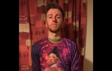 Irish student in serious condition after brutal San Diego attack