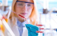 Trinity scientist’s breakthrough discovery on cancer “natural killer” cells