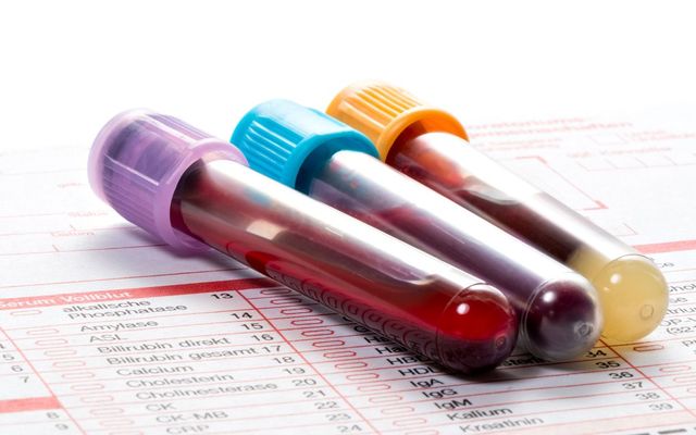 A simple blood test can diagnose Hemochromatosis. 