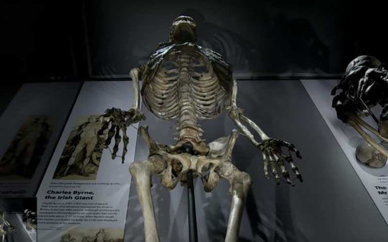 Campaign calls for London museum to return Irish giant’s stolen bones