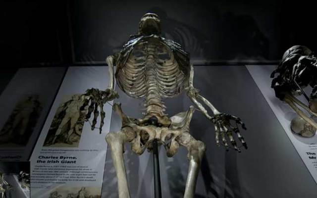 The towering skeleton of \"Irish Giant\" Charles Byrne at the Hunterian Museum at the Royal College of Surgeons in London.