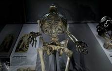 Campaign calls for London museum to return Irish giant’s stolen bones