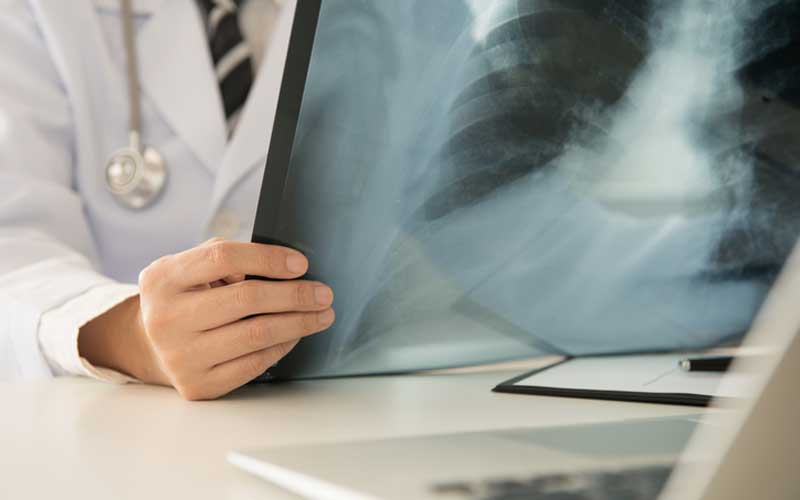 Radiographer in Ireland mistook knee for an elbow, exposed patient's mother to radiation