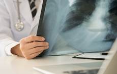 Radiographer in Ireland mistook knee for an elbow, exposed patient's mother to radiation