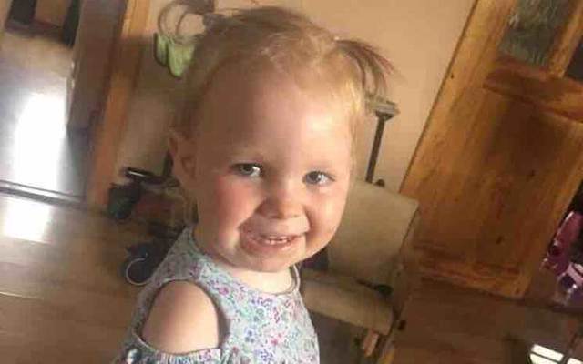 Irish toddler Zoe Murphy, two, is in need of a life-changing operation in the U.S.