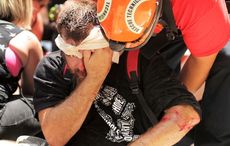 Irish American sues neo-Nazi groups after suffering injuries at Charlottesville