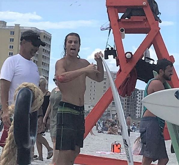 Irish American pro-surfer gets bitten by shark, goes to bar instead of hospital