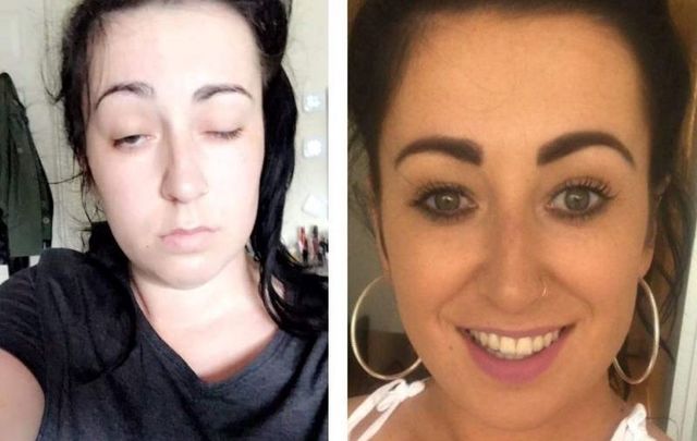 Stephanie Farnan\'s selfie helped provide a timeline for doctors responding to her stroke.