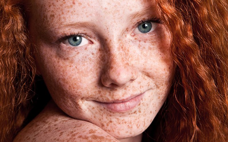 Celts' red hair could be attributed to the cloudy weather