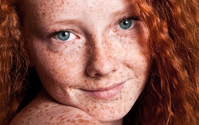 Celts' red hair could be attributed to the cloudy weather 