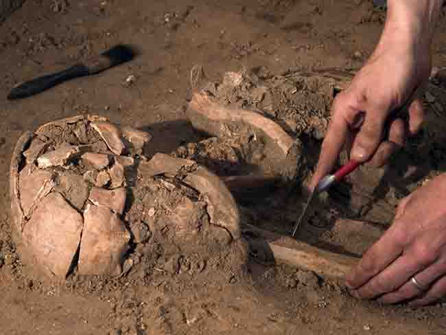 8th century Irish brain surgeons saw cancer and TB
