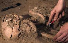 8th century Irish brain surgeons saw cancer and TB