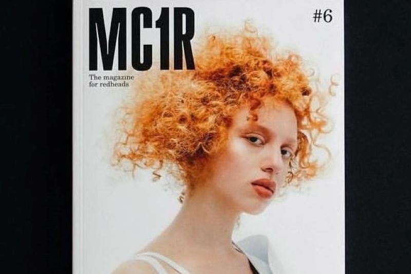 (MC1R Magazine, Facebook)