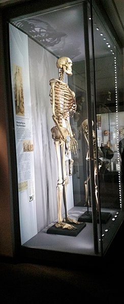 Skeleton of Charles Byrne at the Hunterian Museum. Emőke Dénes/Wikimedia Commons