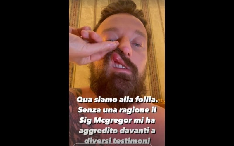 Francesco Facchinetti claims on Instagram that Conor McGregor attacked him for no reason. (Francesco Facchinetti, Instagram)