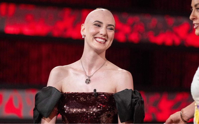 Westmeath Rose Caoilfhinn Ní Choiligh spoke about her battle with alopecia.