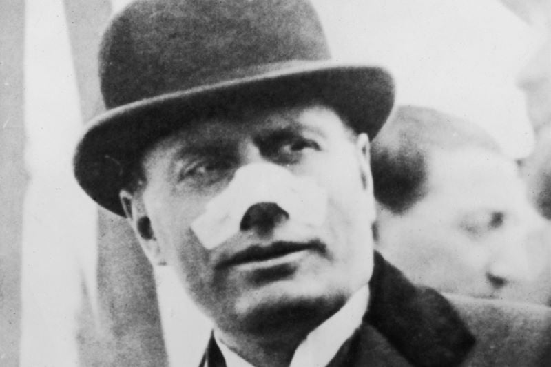 Benito Mussolini after he was shot by Violet Gibson (Getty Images)