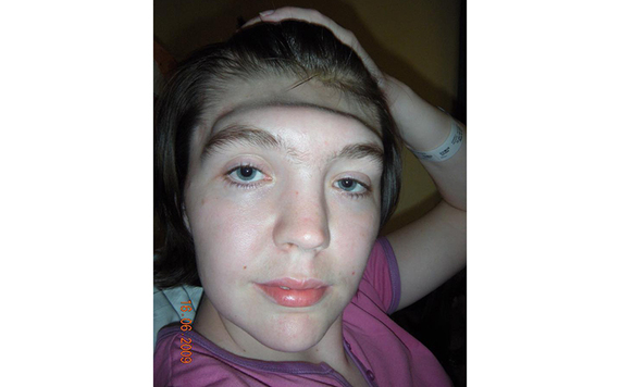 Grainne's horrific injuries, 11 years ago.