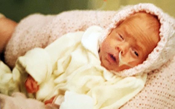 Kate born at 3 pounds in a Limerick hospital.